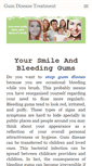 Mobile Screenshot of gumdisease.portfoliobox.me